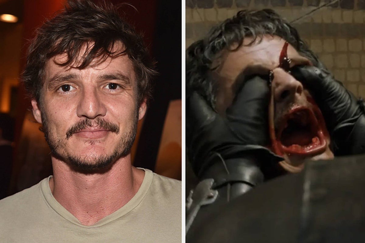 Actor Pedro Pascal left with eye infection from fans recreating his âGame of ThronesâÂ deathÂ scene